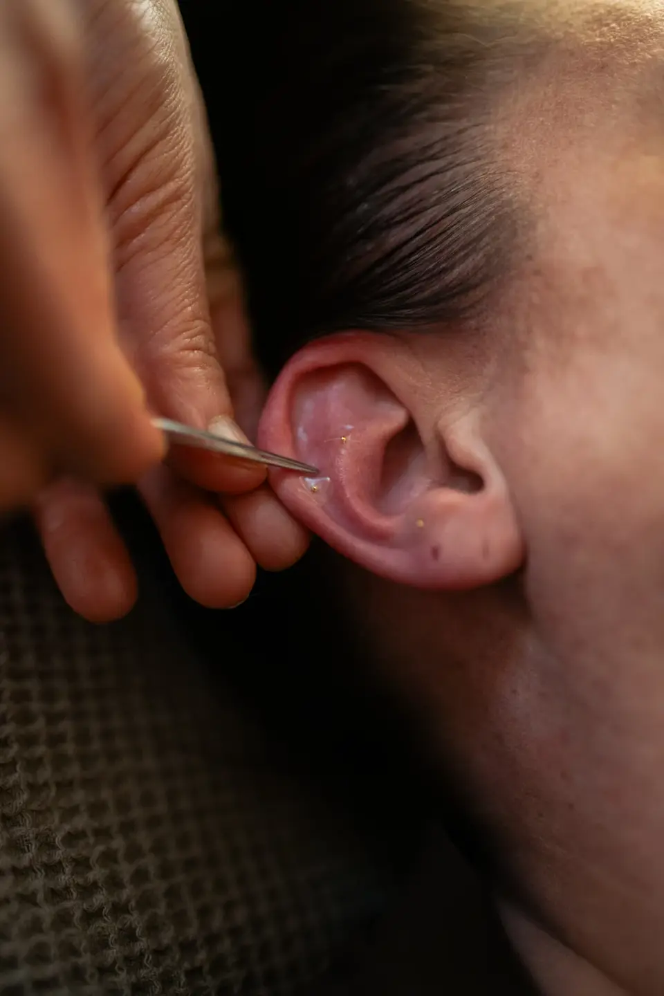 Close-up of an ear reflexology session at manualtherapies, Frederiksberg.